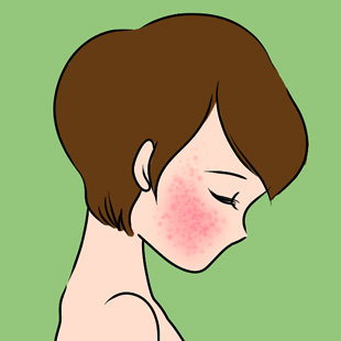 にきびに悩む若者