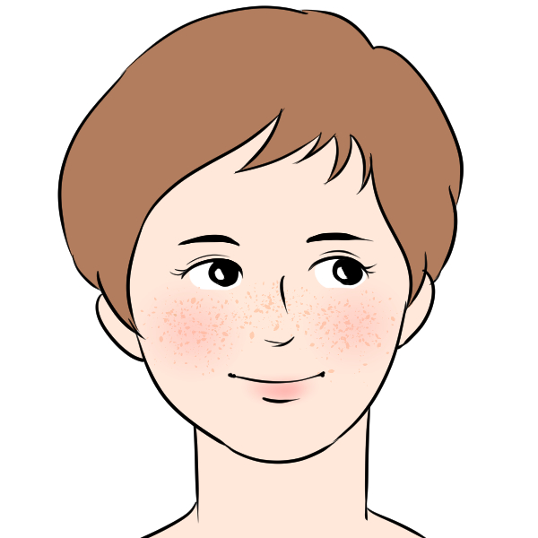 同じところにできるニキビ